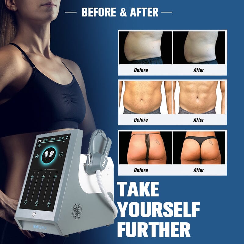 Slimming Machine - RF 4 Handles Manwatstore